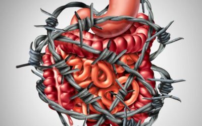 How Does IBS Differ from Other Gut Disorders?