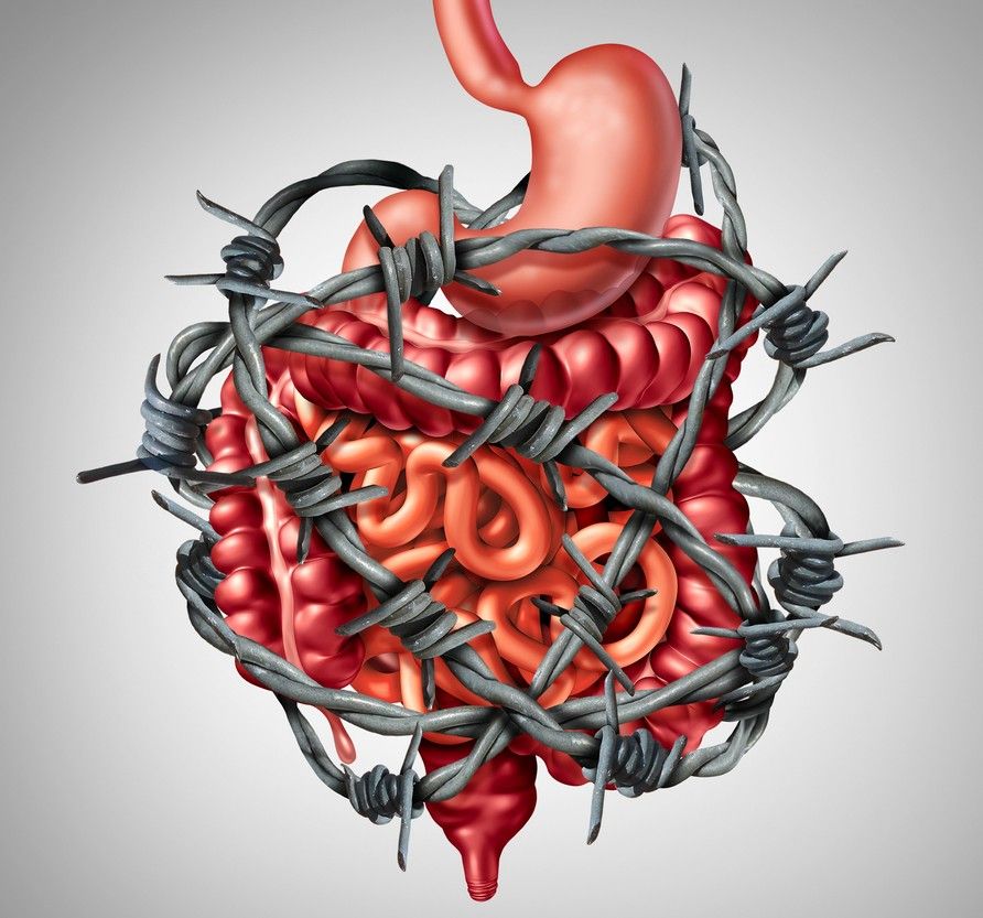 Picture showing a gut wrapped in barbed wire to discuss IBS and Gut disorders